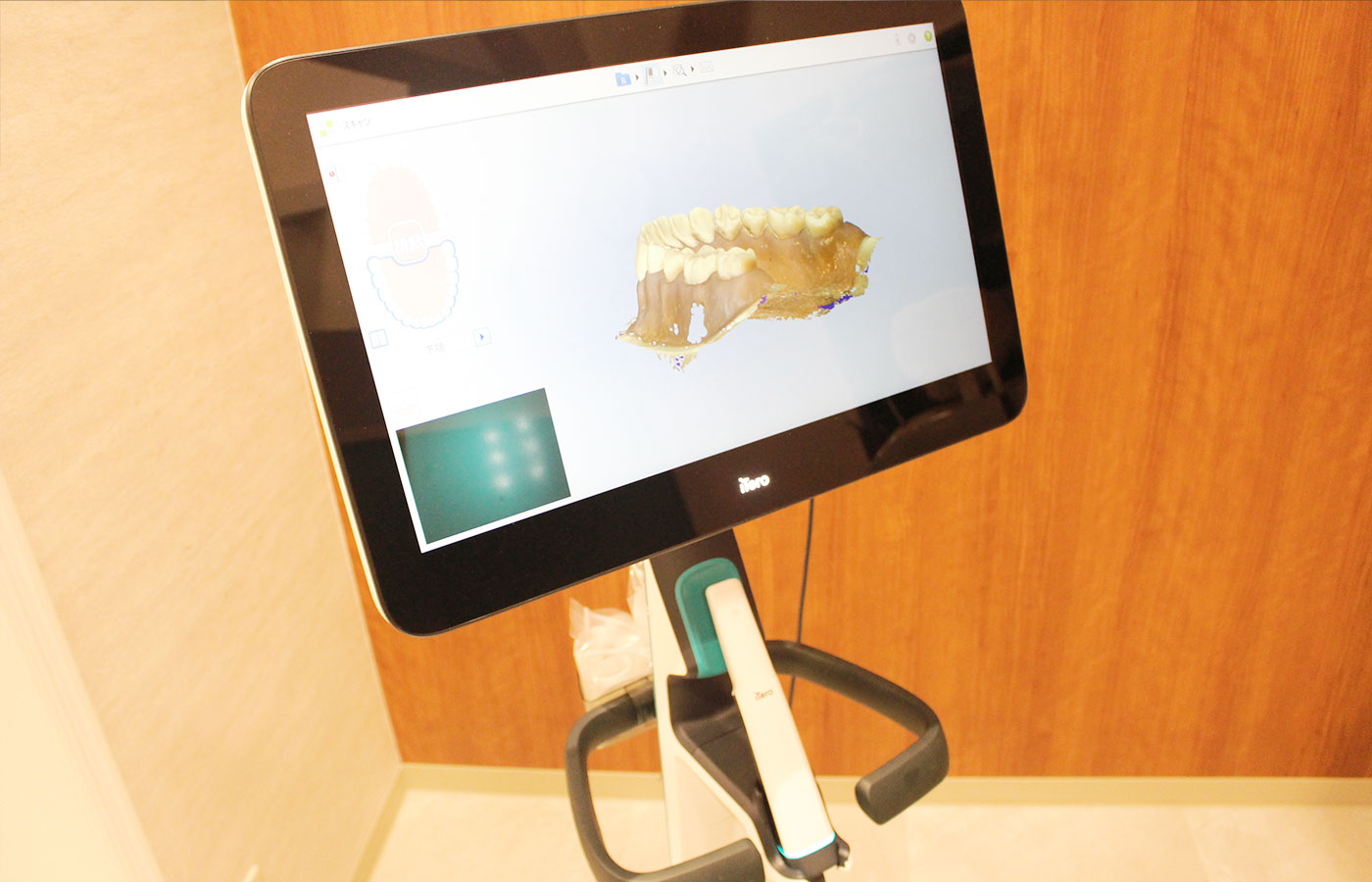 口腔内3Dスキャナー